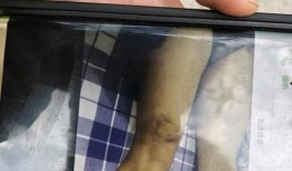 德阳爆料安医生视频,视频揭露惊人真相